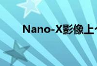 Nano-X影像上个月股价上涨了17%