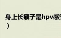 身上长瘊子是hpv感染吗（身上长瘊子的表现）