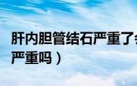 肝内胆管结石严重了会怎么样（肝内胆管结石严重吗）