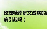 玫瑰糠疹是艾滋病的症状吗（玫瑰糠疹是艾滋病引起吗）