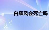 白癜风会死亡吗（白癜风会痒吗）