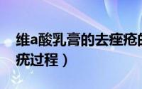 维a酸乳膏的去痤疮的原理（维A酸乳膏的去疣过程）
