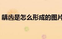 龋齿是怎么形成的图片（龋齿是怎么形成的）
