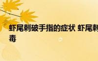 虾尾刺破手指的症状 虾尾刺破手指身亡 吃虾中毒后怎么解毒 