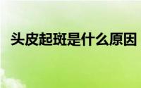 头皮起斑是什么原因（tp钱包是什么意思）