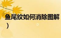 鱼尾纹如何消除图解（鱼尾纹如何消除最彻底）