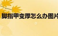 脚指甲变厚怎么办图片（脚指甲变厚怎么办）