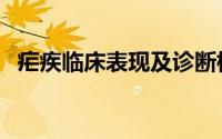 疟疾临床表现及诊断标准（疟疾临床症状）