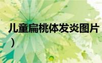 儿童扁桃体发炎图片（儿童扁桃体发炎怎么办）