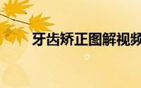 牙齿矫正图解视频（牙齿矫正图解）
