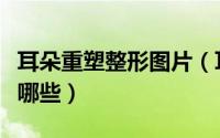 耳朵重塑整形图片（耳朵整形耳再造的方法有哪些）