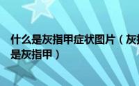 什么是灰指甲症状图片（灰指甲图片初期症状怎么确定是不是灰指甲）