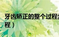 牙齿矫正的整个过程步骤（牙齿矫正的整个过程）