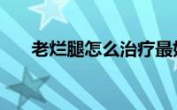 老烂腿怎么治疗最好（老烂腿怎么治）