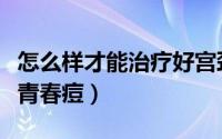 怎么样才能治疗好宫颈炎（怎么样才能治疗好青春痘）