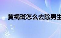黄褐斑怎么去除男生（黄褐斑怎么去除）