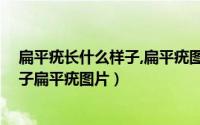扁平疣长什么样子,扁平疣图片,怎么治疗（扁平疣长什么样子扁平疣图片）