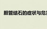 胆管结石的症状与危害（胆管结石的症状）