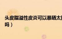 头皮脂溢性皮炎可以暴晒太阳吗（头皮脂溢性皮炎可以根治吗）