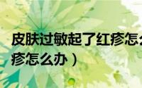 皮肤过敏起了红疹怎么办（下级皮肤过敏起红疹怎么办）