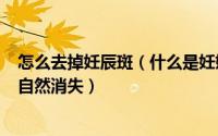 怎么去掉妊辰斑（什么是妊娠斑_去除妊辰斑最佳时间_多久自然消失）