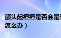 额头起痘痘是否会是缺水导致的（额头起痘痘怎么办）