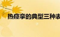 热痉挛的典型三种表现（热痉挛急救法）