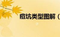痘坑类型图解（痘坑类型图片）