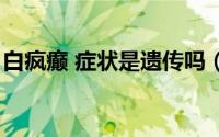 白疯癫 症状是遗传吗（白癫风是怎样遗传的）