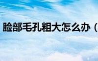 脸部毛孔粗大怎么办（三个方法给大家介绍）