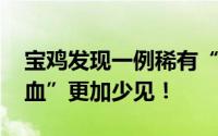 宝鸡发现一例稀有“黄金血”血型 比“熊猫血”更加少见！