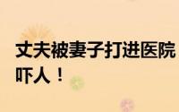 丈夫被妻子打进医院 妇联:属家暴 背后真相太吓人！