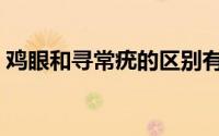 鸡眼和寻常疣的区别有哪些（哪个比较严重）
