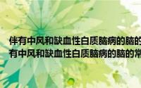 伴有中风和缺血性白质脑病的脑的常染色体隐性遗传的动脉病（关于伴有中风和缺血性白质脑病的脑的常染色体隐性遗传的动脉病的简介）