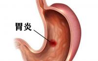 佛山肛泰胃肠医院怎么样？收费不贵看病放心！