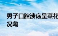 男子口腔溃疡呈菜花状确诊舌癌 到底什么情况嘞