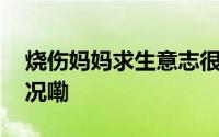 烧伤妈妈求生意志很强要加油啊 到底什么情况嘞