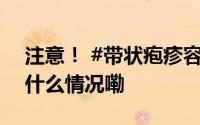 注意！ #带状疱疹容易引发10级疼痛# 到底什么情况嘞