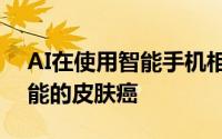 AI在使用智能手机相机拍摄的照片上标记可能的皮肤癌