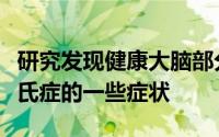研究发现健康大脑部分的补偿可以减轻帕金森氏症的一些症状